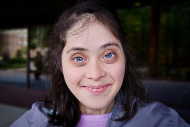 with an open heart . Down Syndrome 